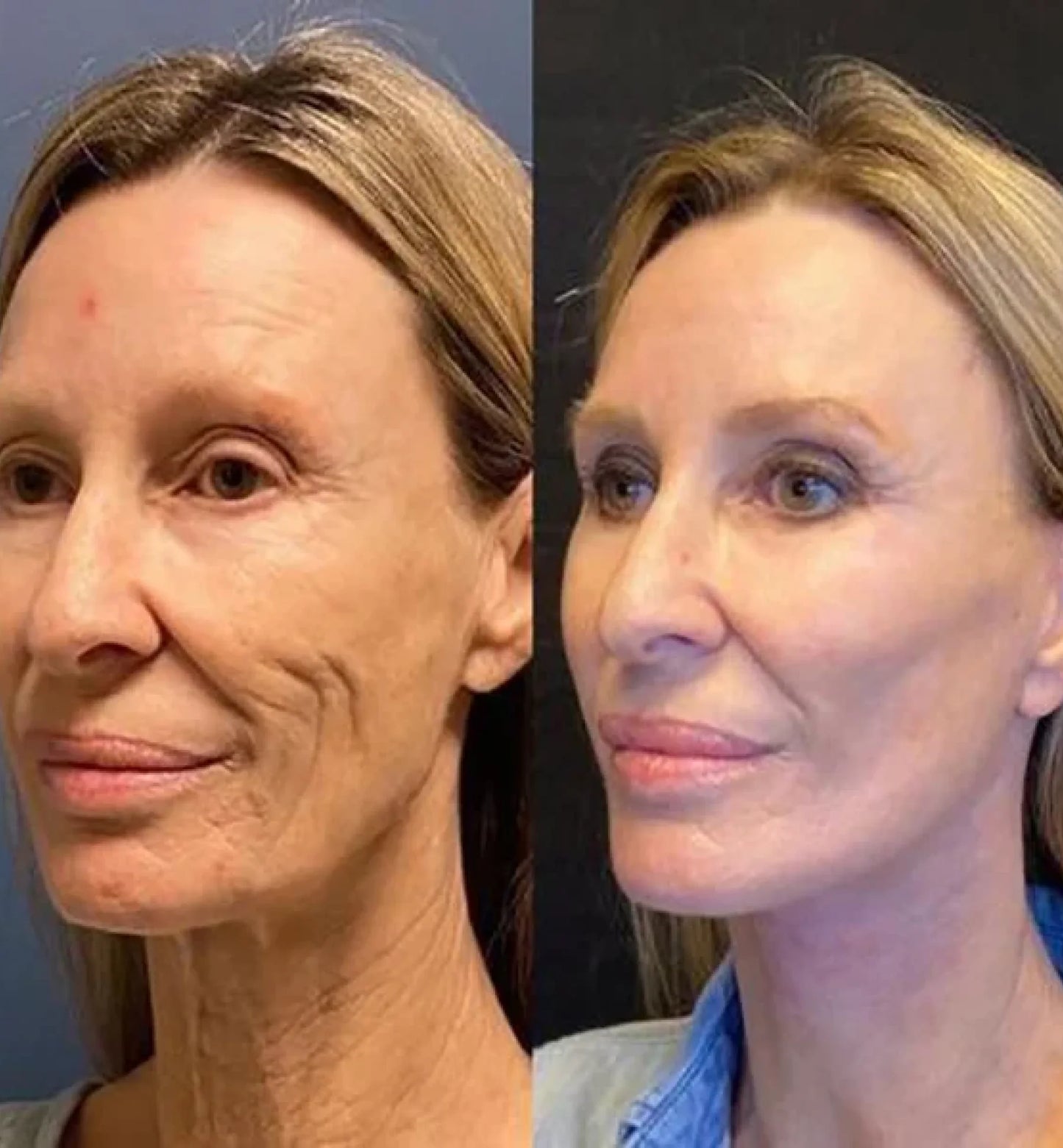 Rejuvae Liquid Solution™