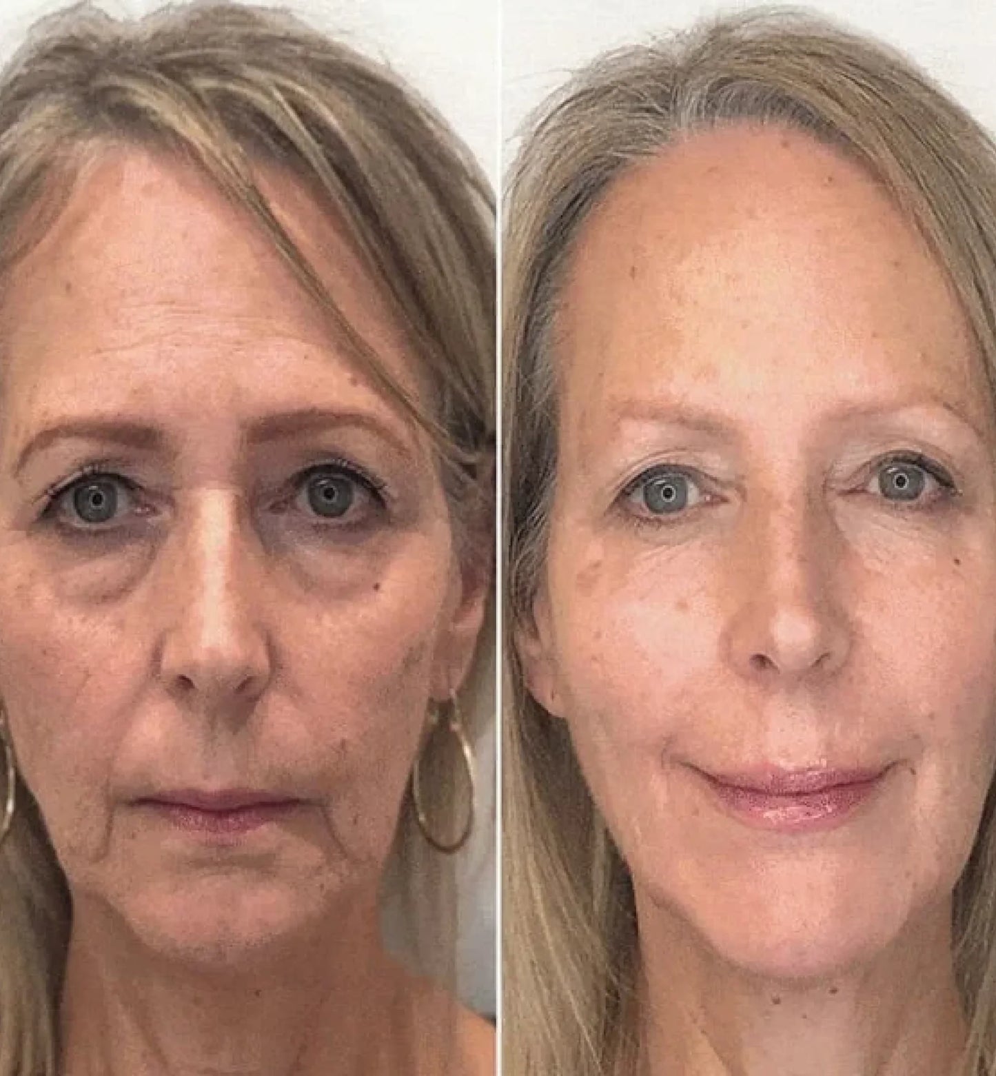 Rejuvae Liquid Solution™